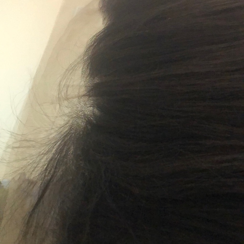 Frontal - Picture 3 of 3